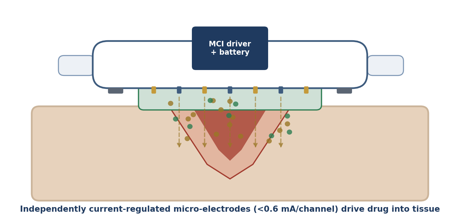 Active Bandage in operation — current-regulated micro-electrodes drive medication down into wounded tissue